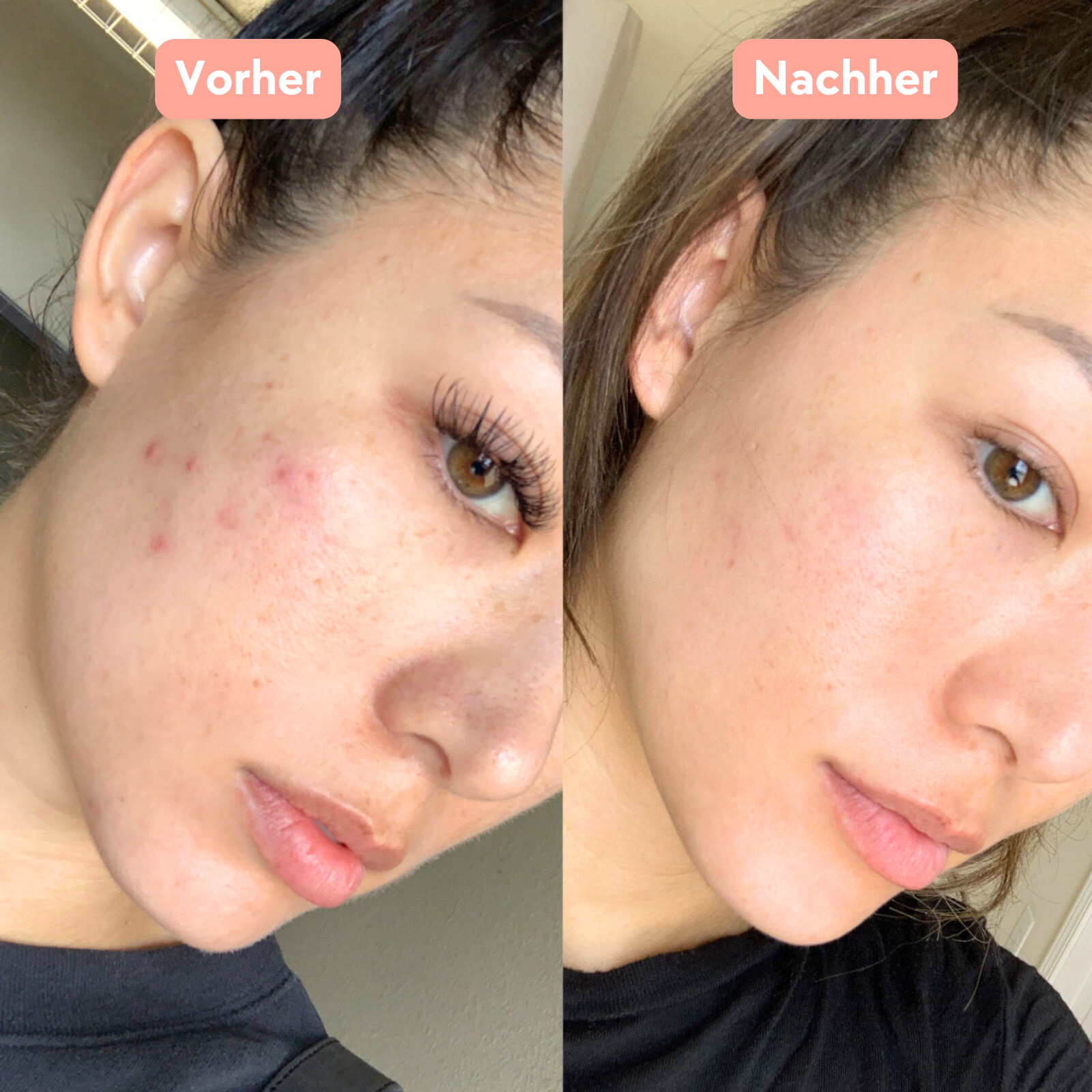 Seiden-Peelinghandschuh für das Gesicht | Glow Getter