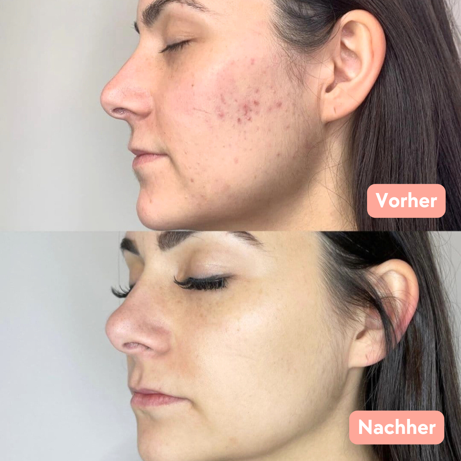 Seiden-Peelinghandschuh für das Gesicht | Glow Getter